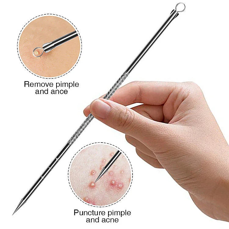 4-Piece Stainless Steel Acne & Blackhead Removal Tool Set – Professional Pimple Extractor Kit for Clear, Healthy Skin